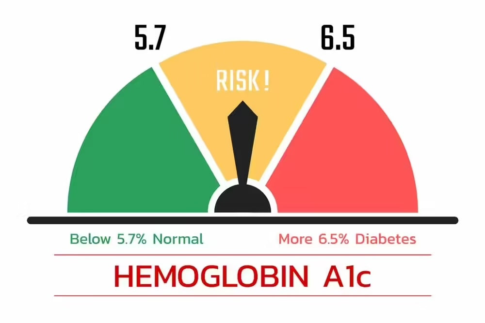 Understanding HbA1c Testing: Why Monitoring Your Levels Matters