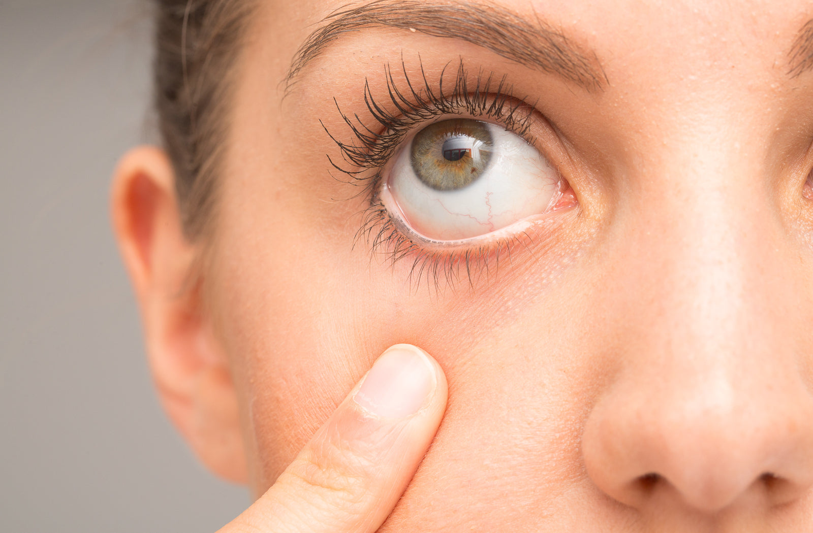 Omega-3: A Natural Remedy for Dry Eye Syndrome - omega3index.shop